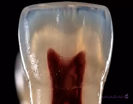 آناتومی کانال ریشه و تایپ‌های مختلف کانال؛ از تشخیص تا آماده‌سازی و آبچوریشن